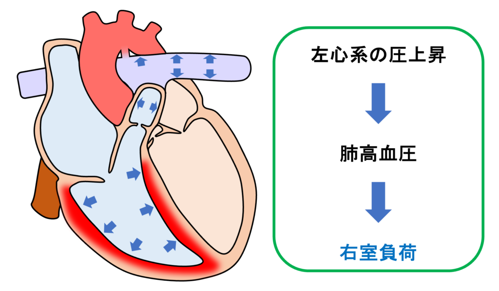 動脈管開存症(patent ductus ateriosus)