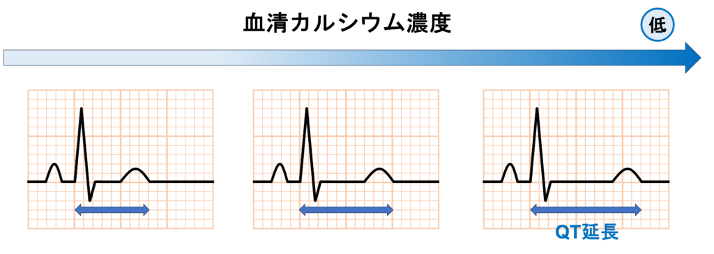 低カルシウム血症(Hypocalcemia)