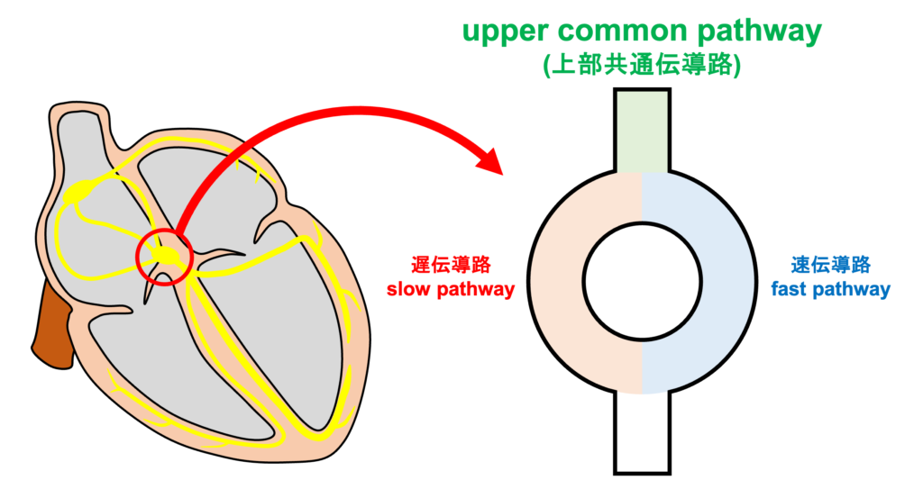 upper common pathway(上部共通伝導路)