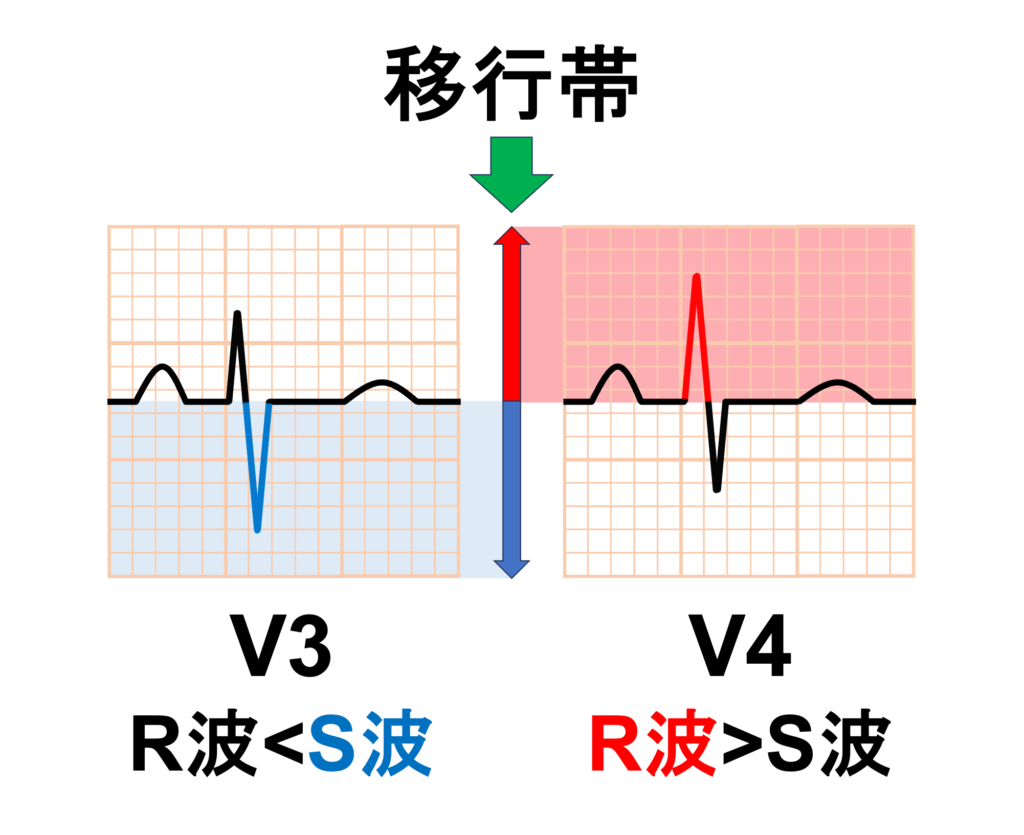 移行帯(transitional zone)