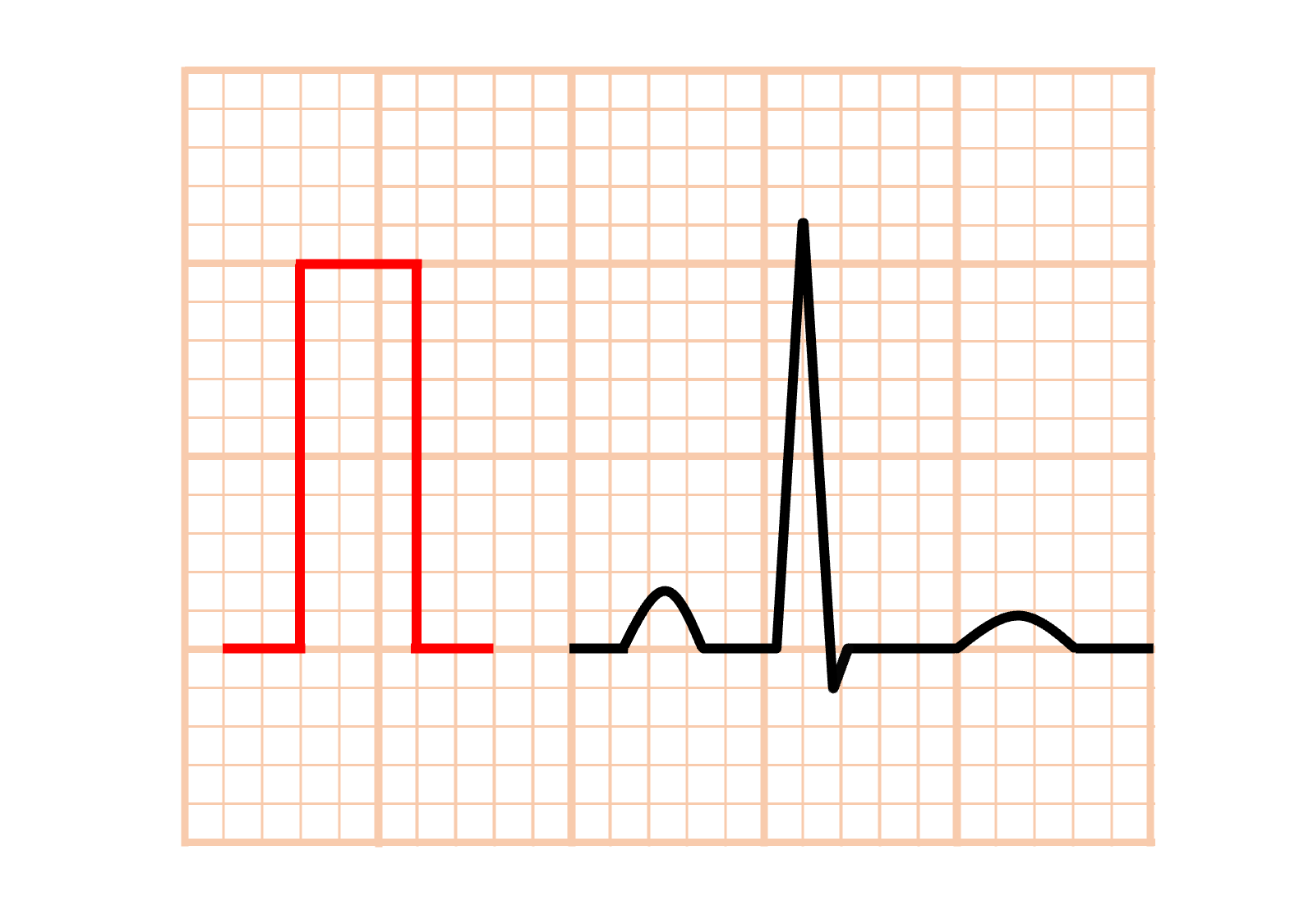 較正波(calibration)
