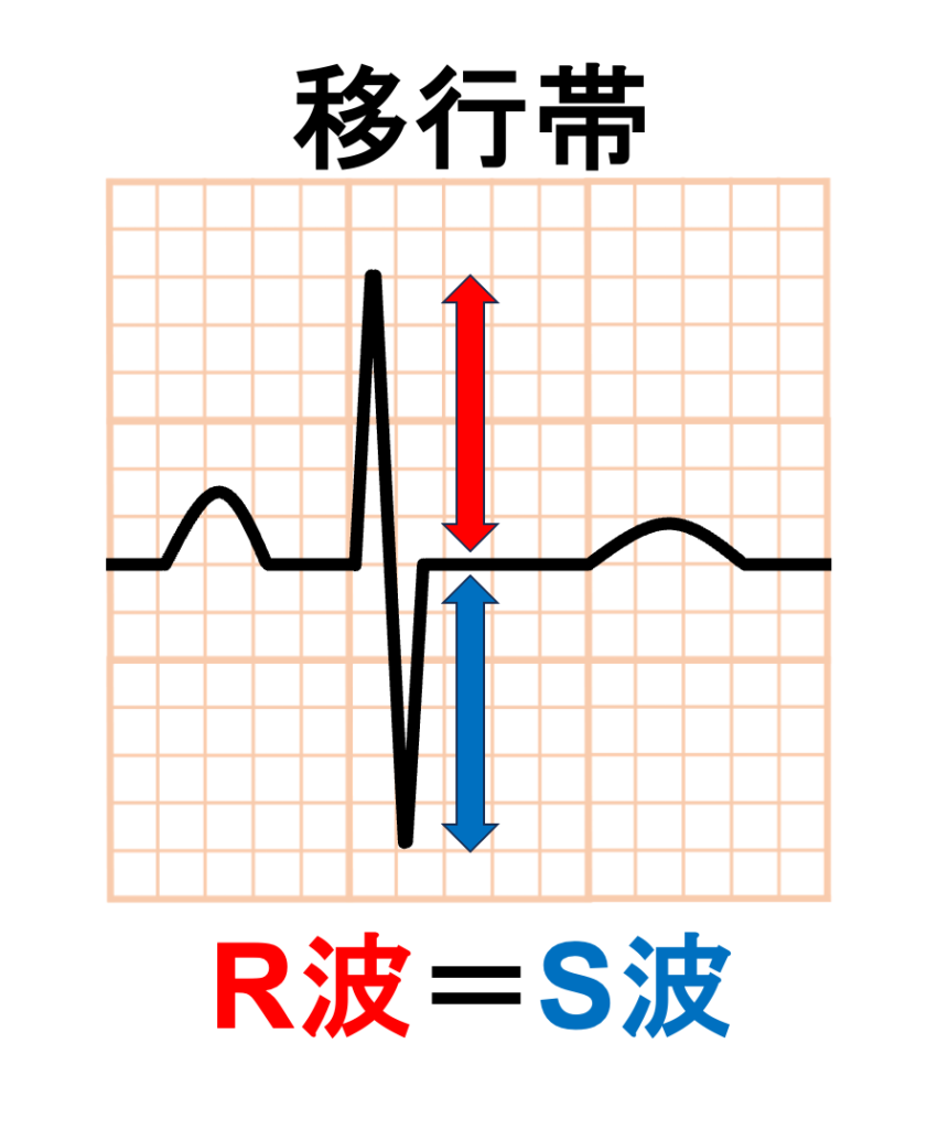 移行帯(transitional zone)
