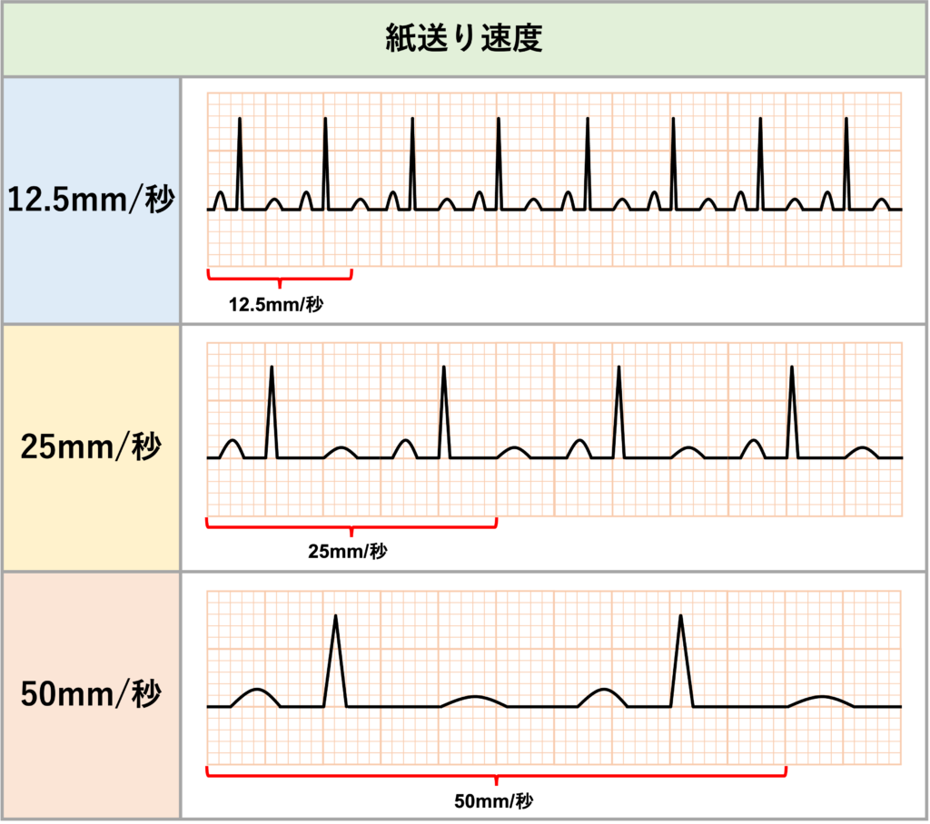 紙送り速度(paper speed)