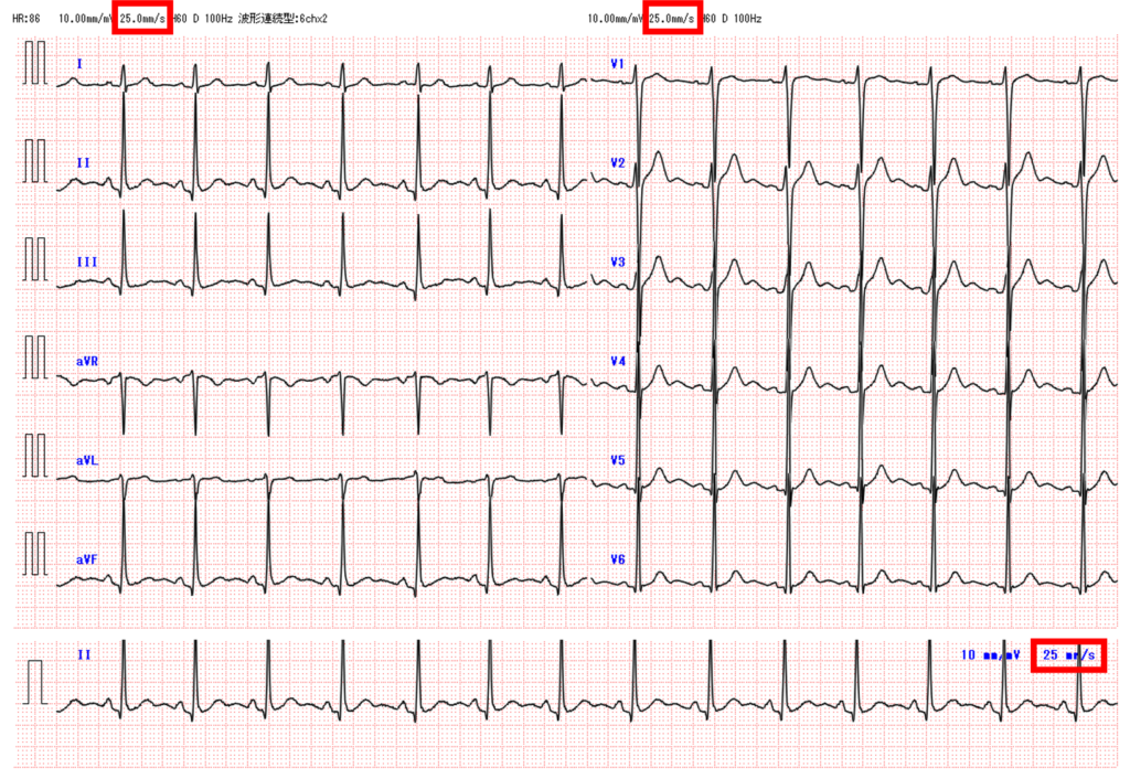 紙送り速度(paper speed)