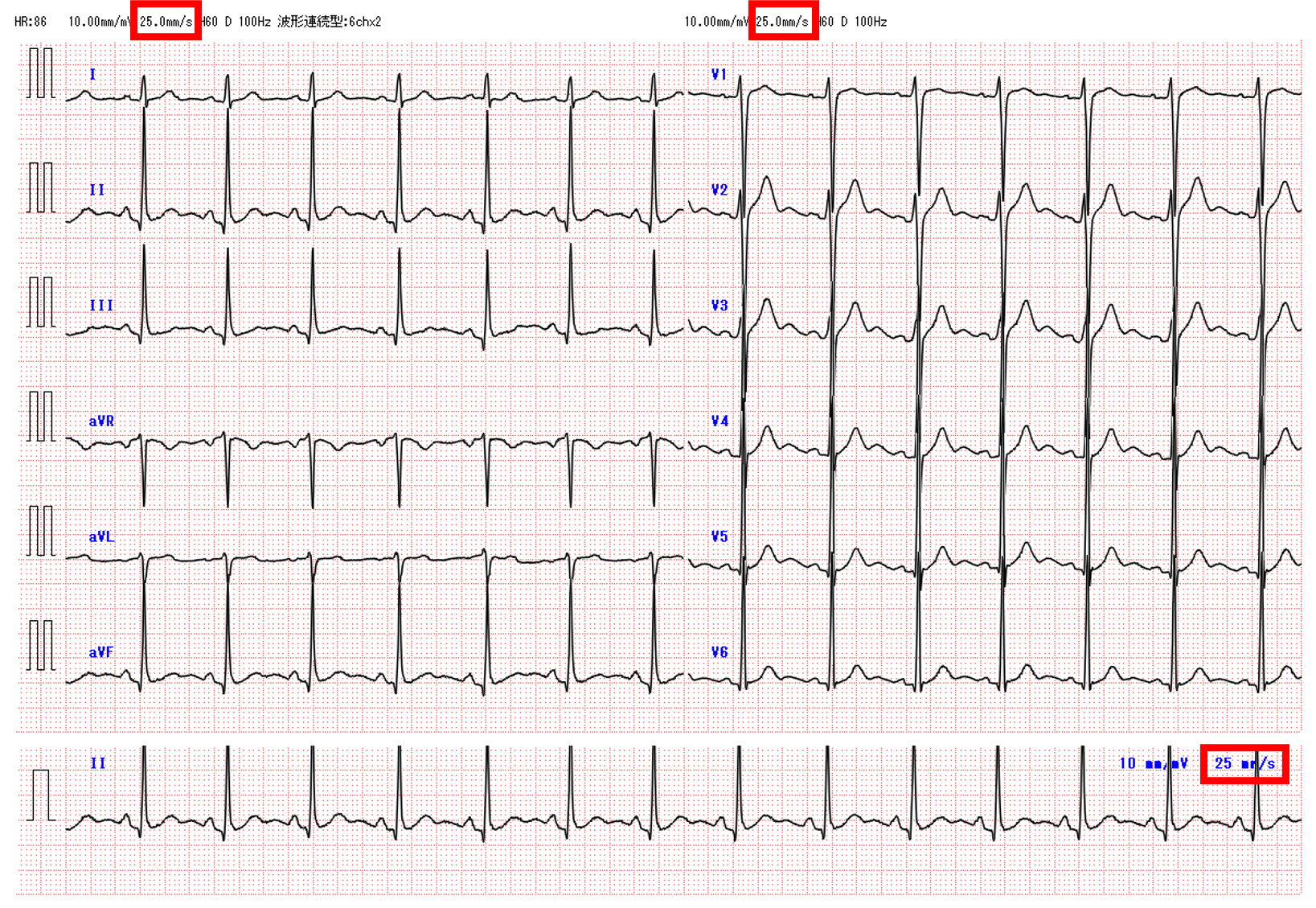 紙送り速度(paper speed)