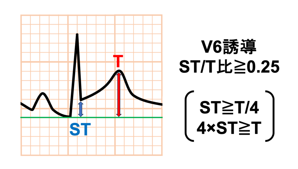 急性心膜炎(acute pericarditis)