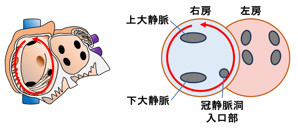 心房粗動(Atrial flutter)