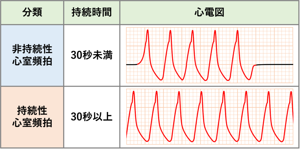 非持続性心室頻拍(Non-sustained ventricular tachycardia: NSVT)