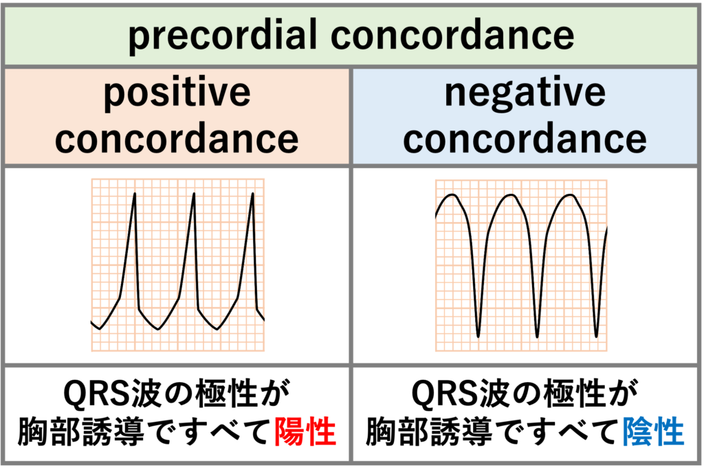 precordial concordance