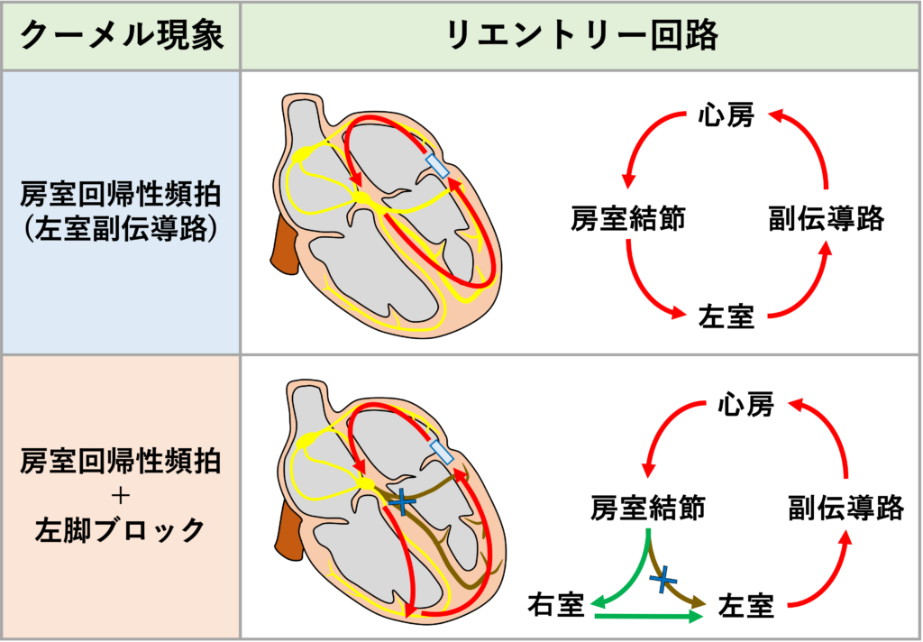 クーメル現象(coumel phenomenon)