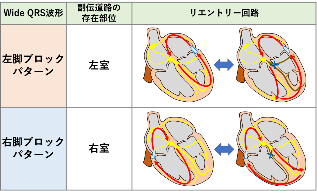 クーメル現象(coumel phenomenon)