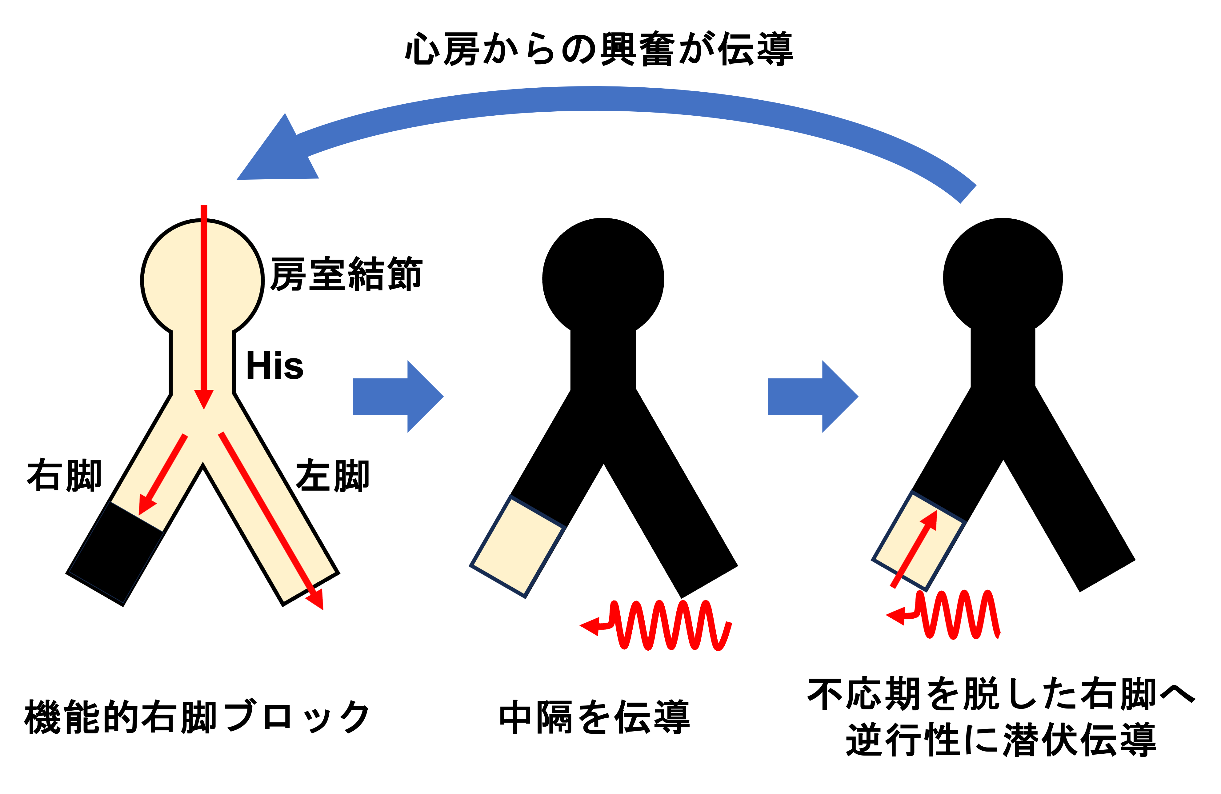 Linking現象(Linking Phenomenon)