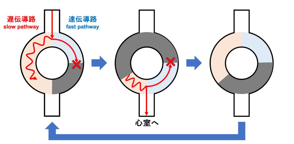 Linking現象(Linking Phenomenon)