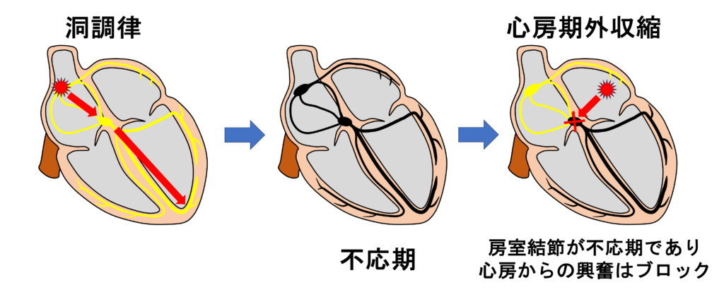 不応期(refractory period)
