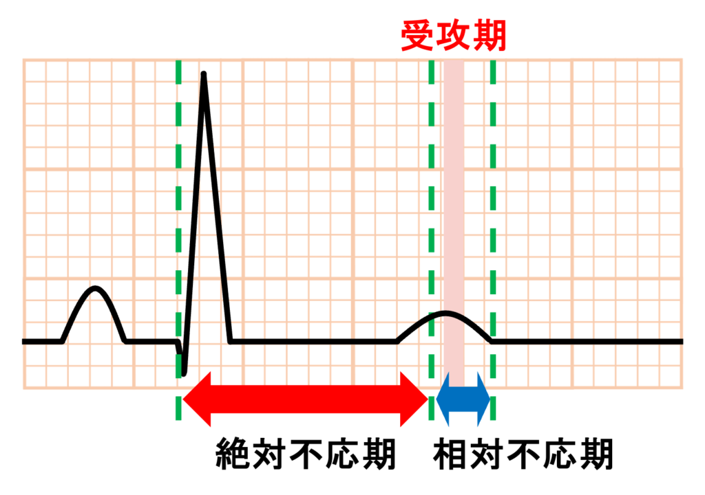 不応期(refractory period)