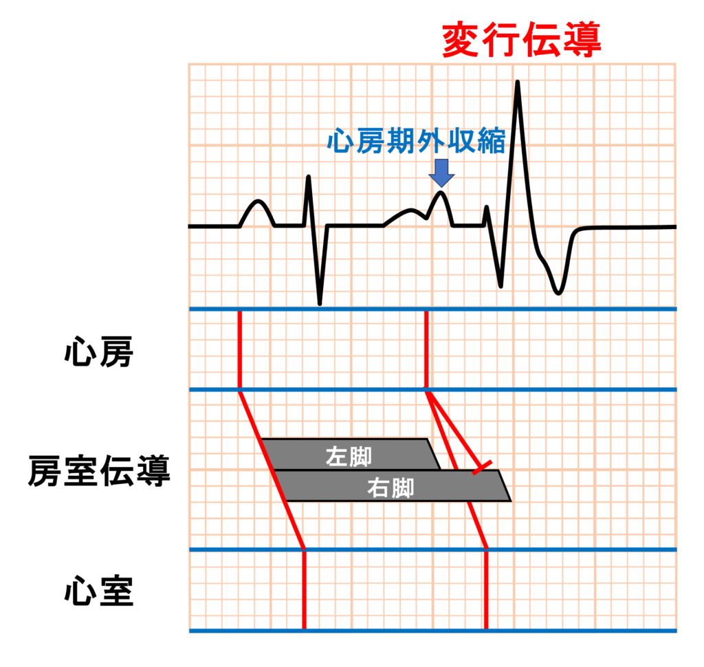 不応期(refractory period)