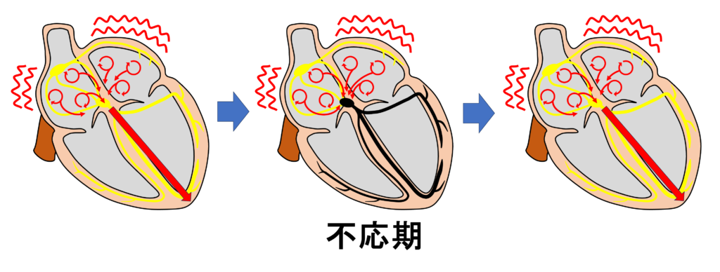 不応期(refractory period)