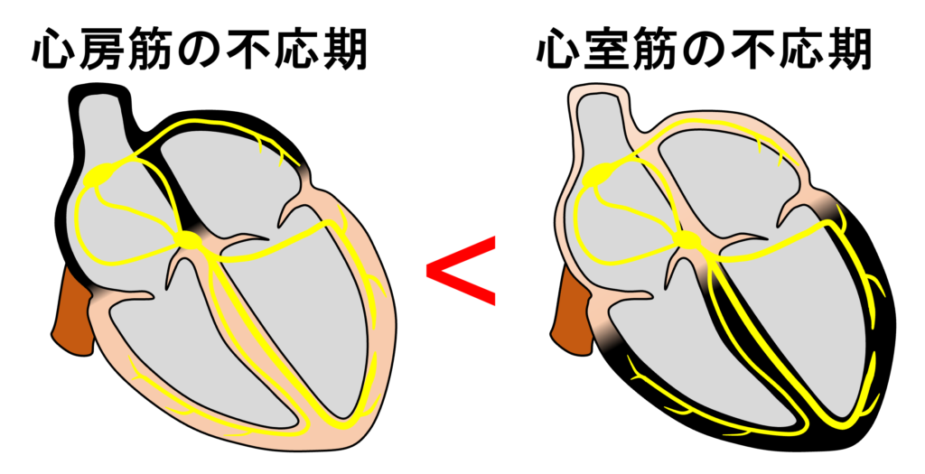 不応期(refractory period)