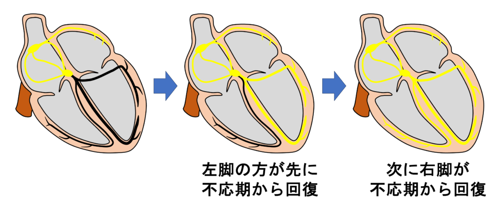 不応期(refractory period)
