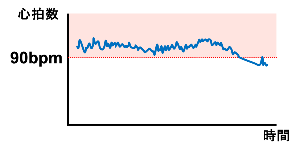 不適切洞頻脈(inappropriate sinus tachycardia)
不適切洞頻脈の診断基準として「安静時心拍数>100bpm、24時間平均心拍数>90bpm」がよく利用されています
