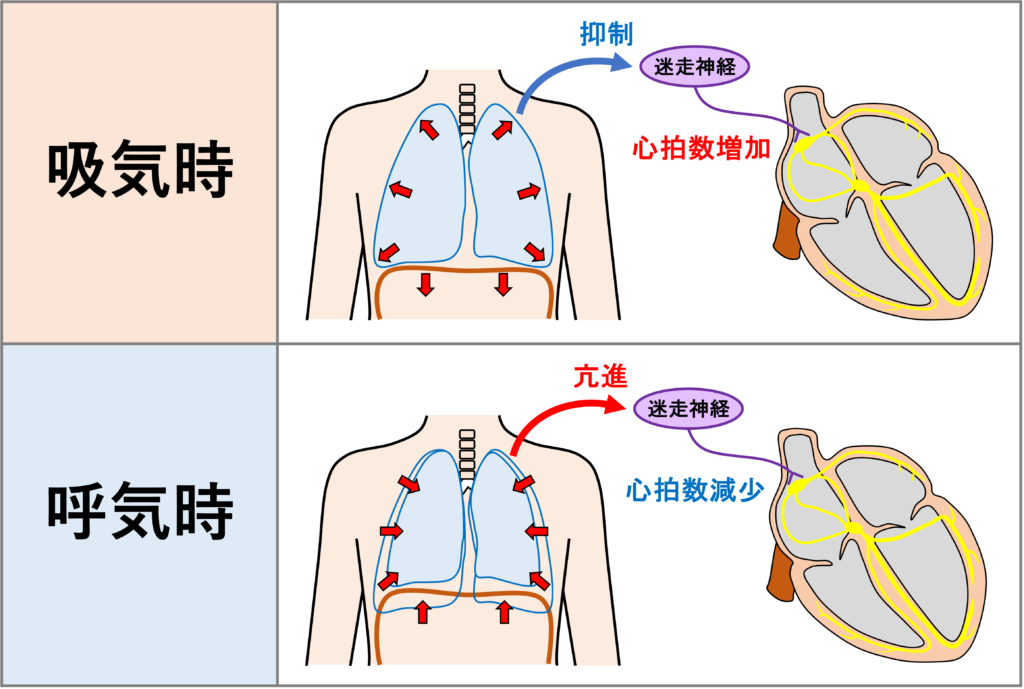 洞性不整脈(sinus arrhythmia)
呼吸性洞性不整脈(Respiratory Sinus Arrhythmia)