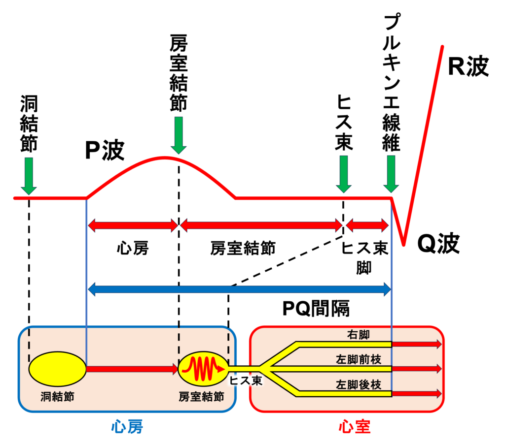 PQ間隔(PQ interval)
PQ間隔はほぼ房室結節の伝導時間に依存しています。P波開始時点で房室結節は興奮していないのでイコールではありませんが、房室結節の伝導時間の指標になります。