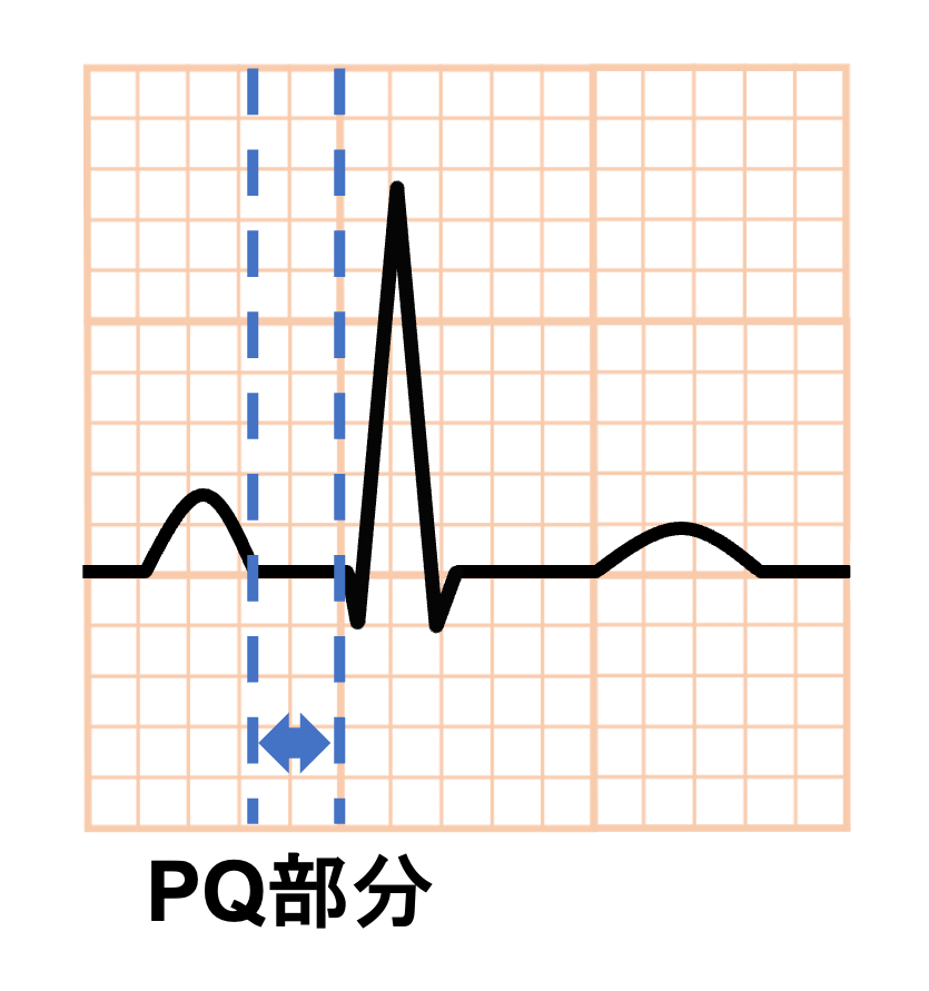 PQ部分(PQ segment)