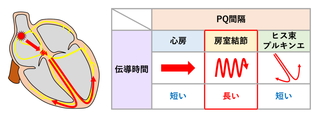 PQ間隔(PQ interval)
PQ間隔はほぼ房室結節の伝導時間に依存しています。P波開始時点で房室結節は興奮していないのでイコールではありませんが、房室結節の伝導時間の指標になります。