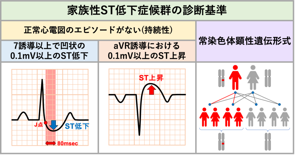 家族性ST低下症候群(familial ST-depression syndrome)
診断基準