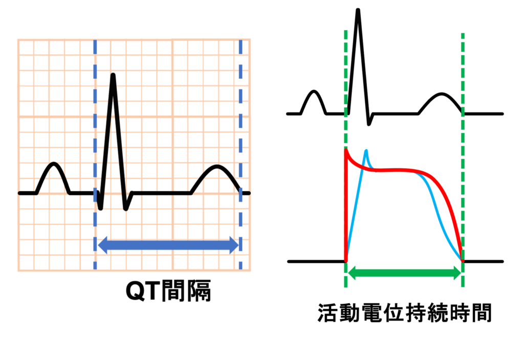 QT間隔(QT interval)
