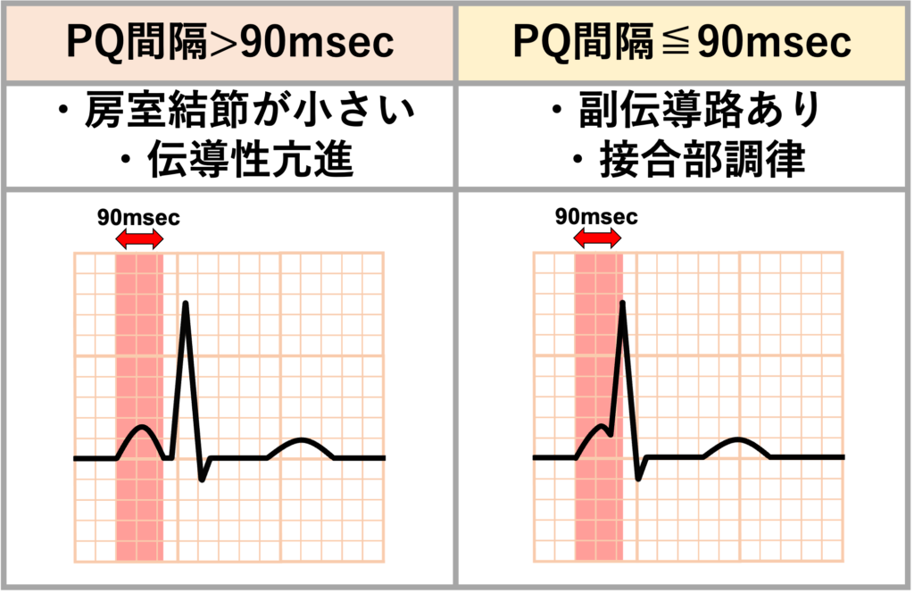 PQ間隔(PQ interval)