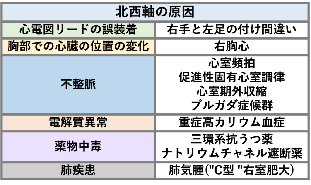 北西軸(northwest QRS axis)
北西軸は、肺気腫、徐脈、心電図リードの誤装着(右手と左足の電極が逆)、高度の高カリウム血症、三環系抗うつ薬やナトリウム拮抗薬の中毒、ブルガダ症候群などと関連しています