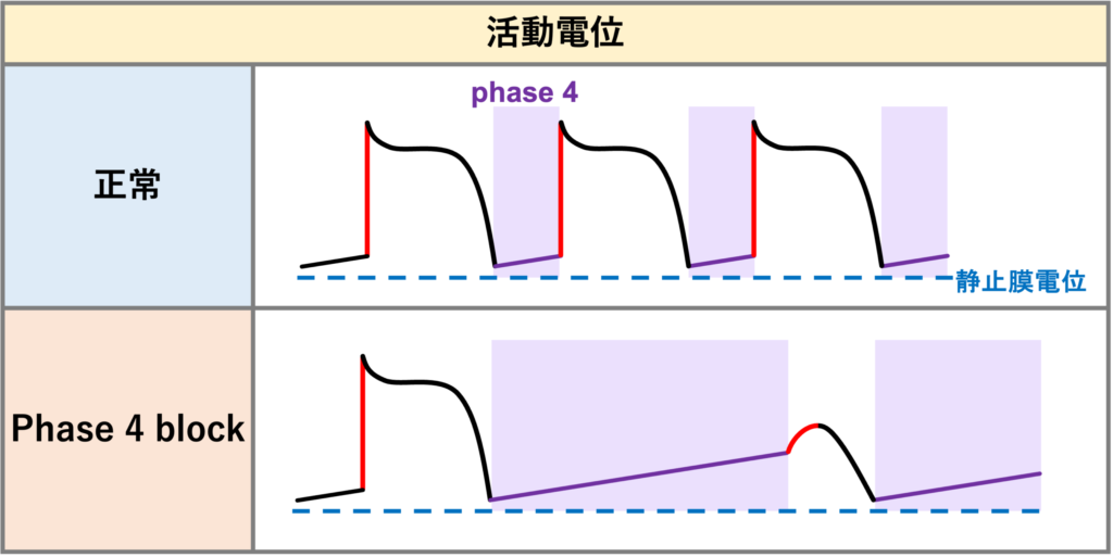 phase 4 block
phase 4 blockとはヒス束-プルキンエ系の器質的障害がある心臓で、pauseや徐脈の後に次の興奮が伝導されなくなる現象です。自動能を有する刺激伝導系の心筋細胞では活動電位のphase 4で自然に脱分極が進み、静止膜電位が徐々に上昇しますが、通常よりも電位が上昇してしまうことによりNaチャネルが不活性化され、次の刺激が到達したときに興奮が伝わらなくなります。一方で頻拍依存性で心拍数が速くなるとブロックが出現する場合はphase 3 blockになります。