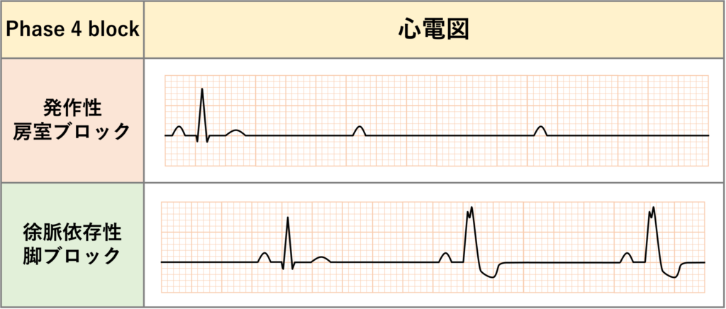 phase 4 block
phase 4 blockは発作性房室ブロックの主要機序の一つと考えられています。徐脈依存性脚ブロックもphase 4 blockが原因であり左脚ブロック型が多いとされています。