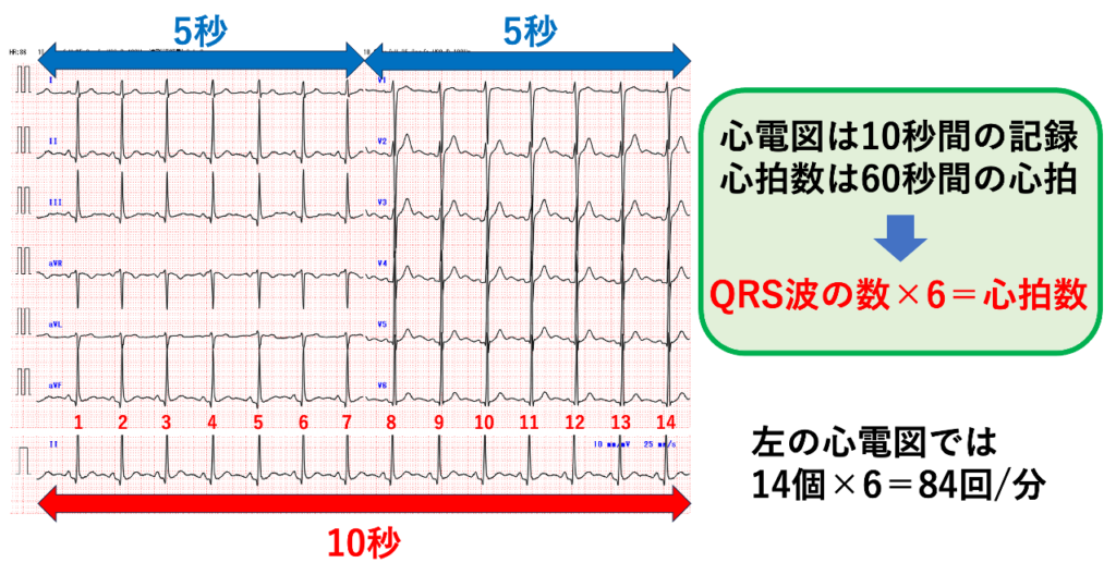 心拍数(heart rate)
心電図の記録用紙では10秒間の波形を記録しています。よって、記録されたQRS波の数を6倍することで60秒間の波形数を求めることができ、これが心拍数になります。