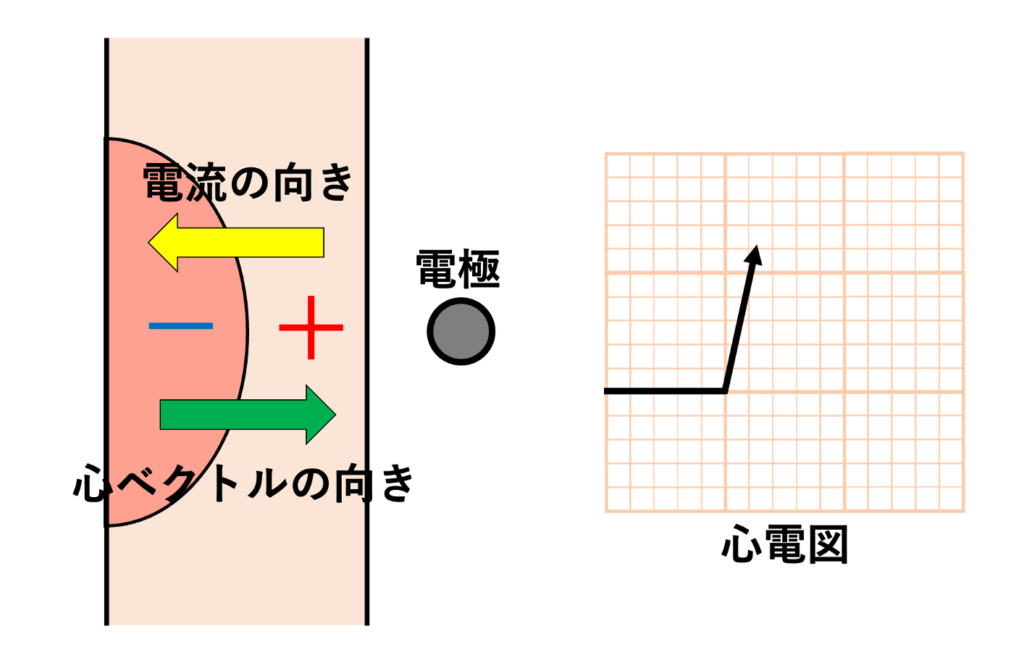 双極子(dipole)
ちなみに「電流の向き」と「心ベクトルの矢印の向き」は逆になっていますが、心ベクトルがプラス電極に向かうと陽性波になるように設計されているので、「脱分極がプラス電極に向かって進むと陽性波」「脱分極がプラス電極から遠ざかると陰性波」という直感的なルールで波形を解釈できるようになっています。