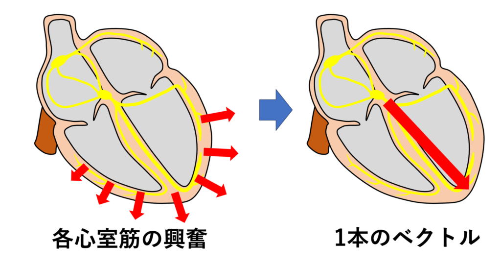 心ベクトル(cardiac vector)
心ベクトルとは、心筋の興奮によって生じる起電力を「大きさ」と「方向」を持ったベクトル(矢印)として表現したものです。心ベクトルは「心臓の電気的活動を1本の矢印で表現する概念」であり、心電図波形の成り立ちや電気軸、軸偏位などを理解する上での基本的な考え方です。