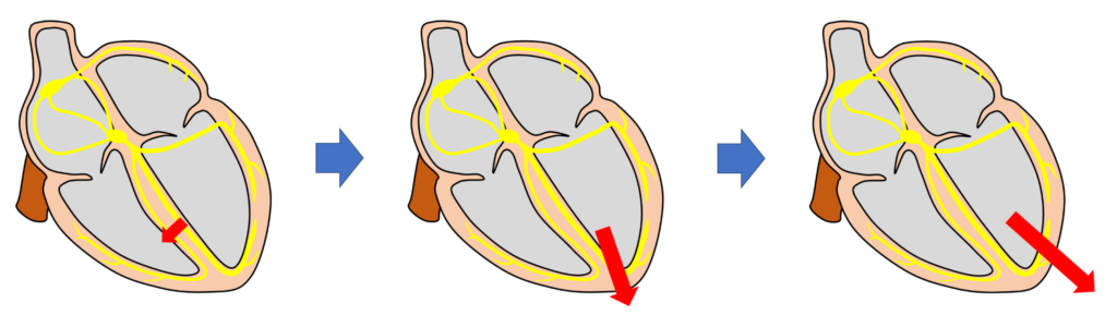 心ベクトル(cardiac vector)
瞬間ベクトル(instantaneous vector)
ある特定の瞬間における心臓全体の合成ベクトル。時間とともに大きさも方向も刻々と変化します。