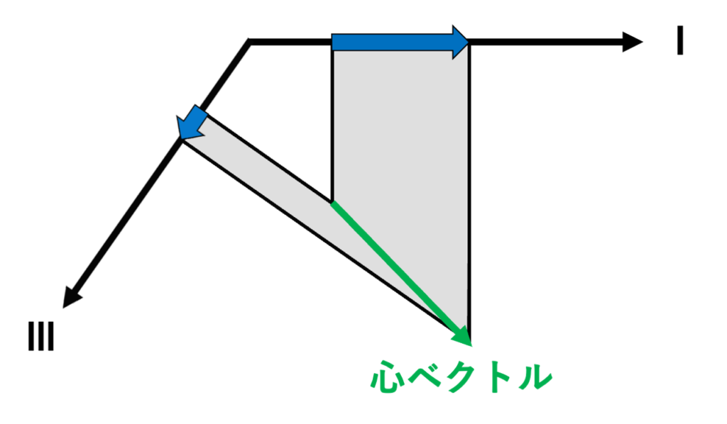 心ベクトル(cardiac vector)