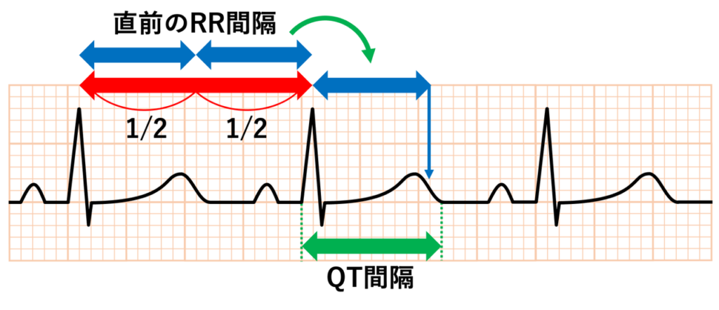 Half RR rule
厳密には直前のRR間隔を用いて判断します。T波を含む部分のRR間隔ではありません。これはBazett補正式などでも同じで、QTc計算時に用いるRR間隔もそのQT間隔に先行するRR間隔を使うのが原則です。これはQT間隔が直前のRR間隔に依存して変化するためです。
