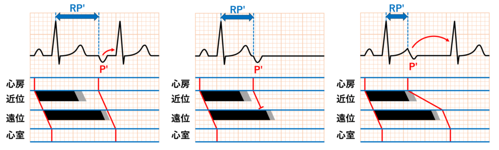 gap現象(gap phenomenon)