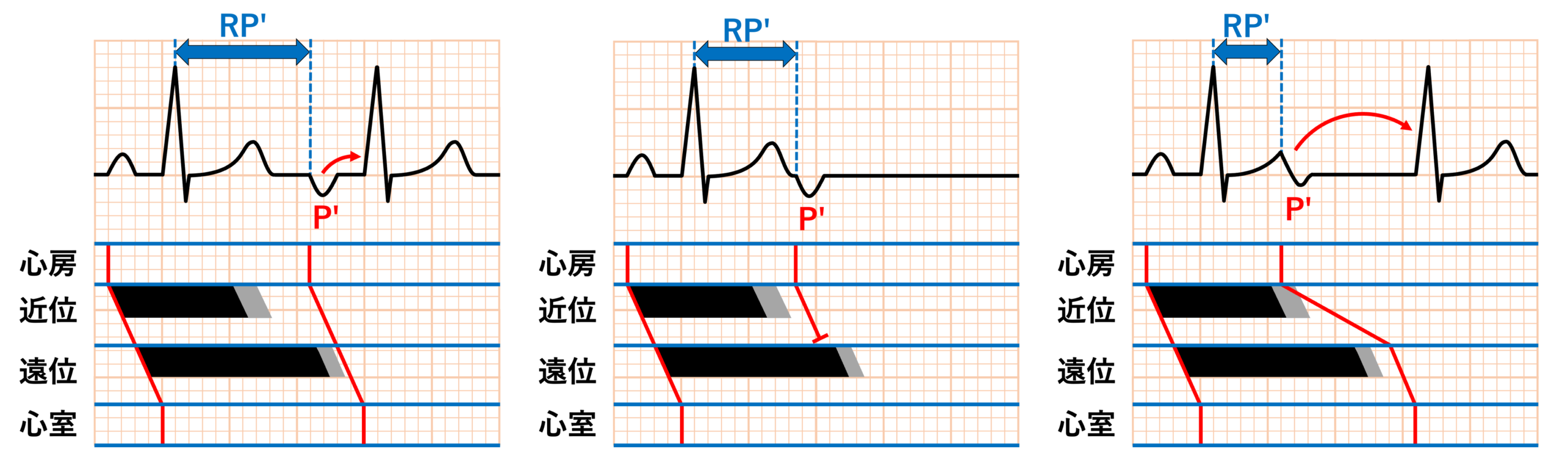 gap現象(gap phenomenon)