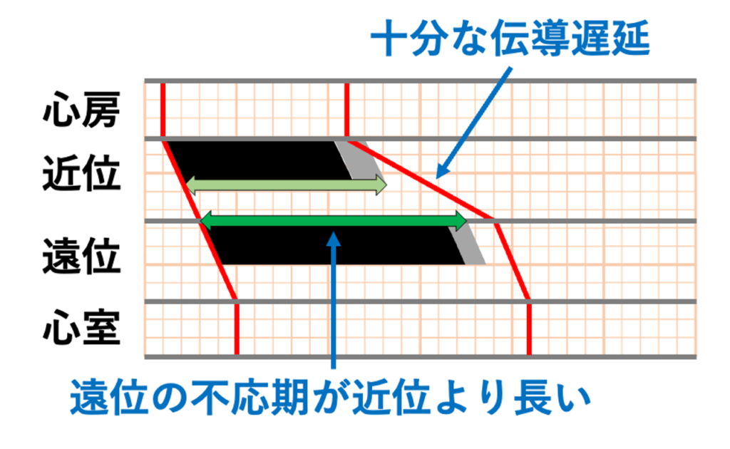 gap現象(gap phenomenon)