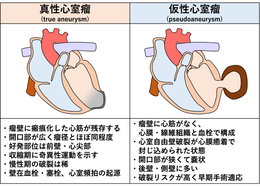 心室瘤(aneurysm)