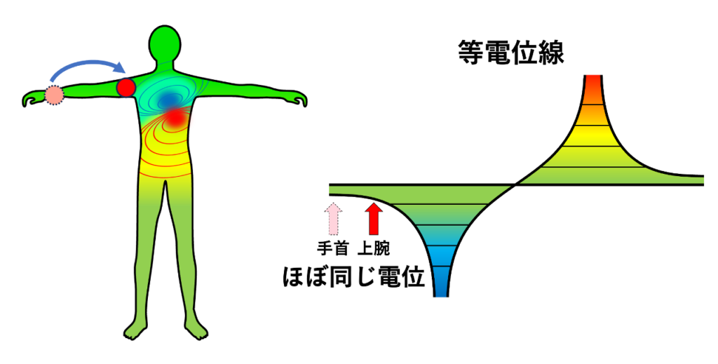 肢誘導(limb leads)