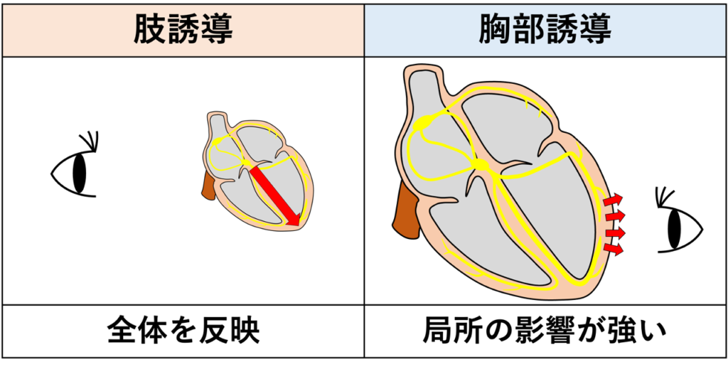 肢誘導(limb leads)