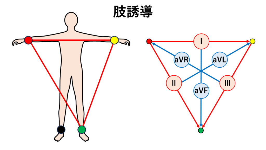 肢誘導(limb leads)