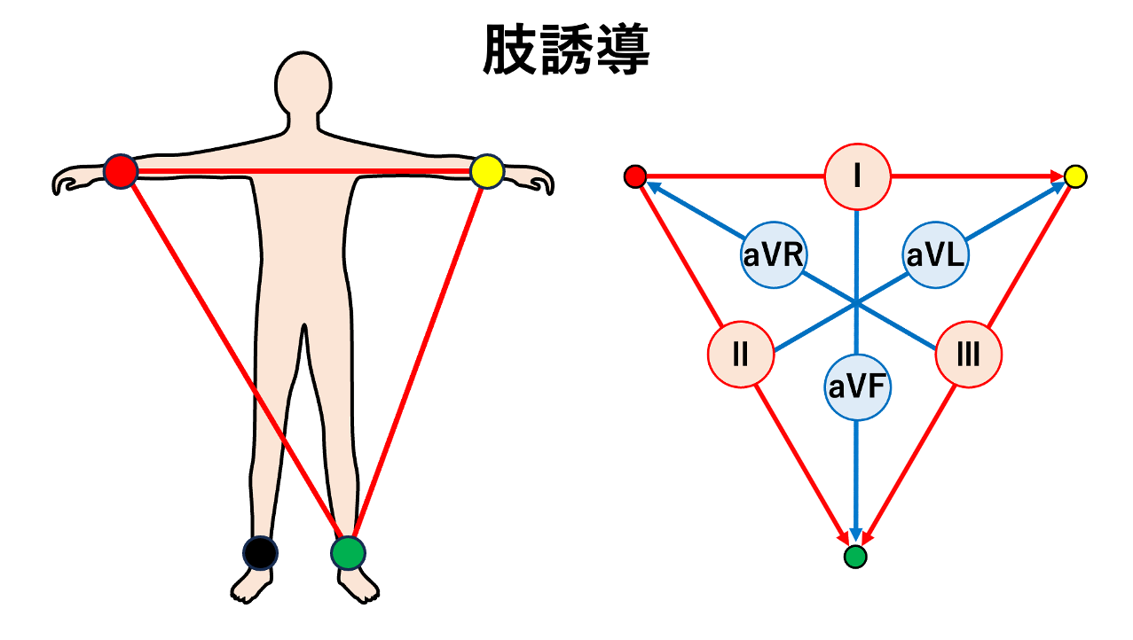 肢誘導(limb leads)
