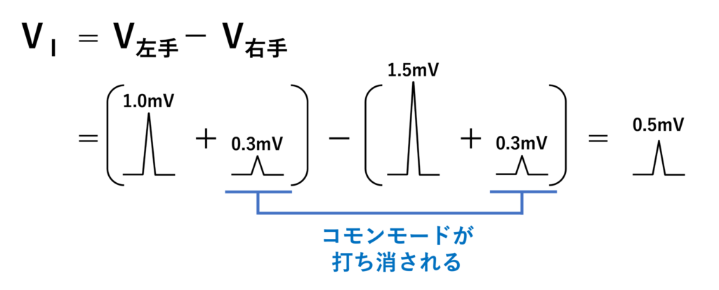 コモンモード(common mode)