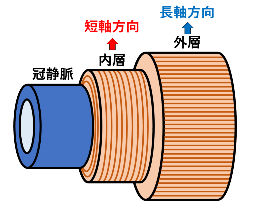 冠静脈洞内筋束
静脈壁の外側に心房由来の心筋線維が走行しているという構造ですが、均一に筒状に心筋が包んでいるのではなく厚さや分布には偏りがあります。冠静脈洞内筋束を構成する筋線維は、長軸方向と短軸(円周)方向の両方があります。 ヒトの組織学的研究では、冠静脈洞入口部の心筋は典型的に2層で内層は血管の長軸方向、外層は血管を取り巻く円周方向でした2)。冠静脈洞入口部からは平均40±8mm伸びていると報告されています。